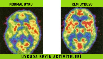 normal-uyku-rem-uykusu-uykuda-beyin-aktiviteleri