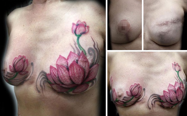 mastectomy-abuse-scar-women-free-tattoo-