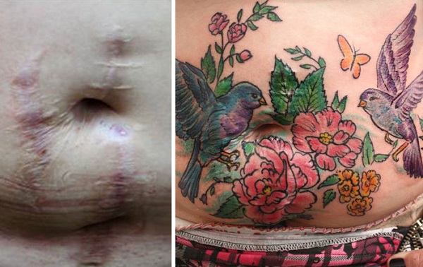 mastectomy-abuse-scar-women-free-tattoo-flavia-