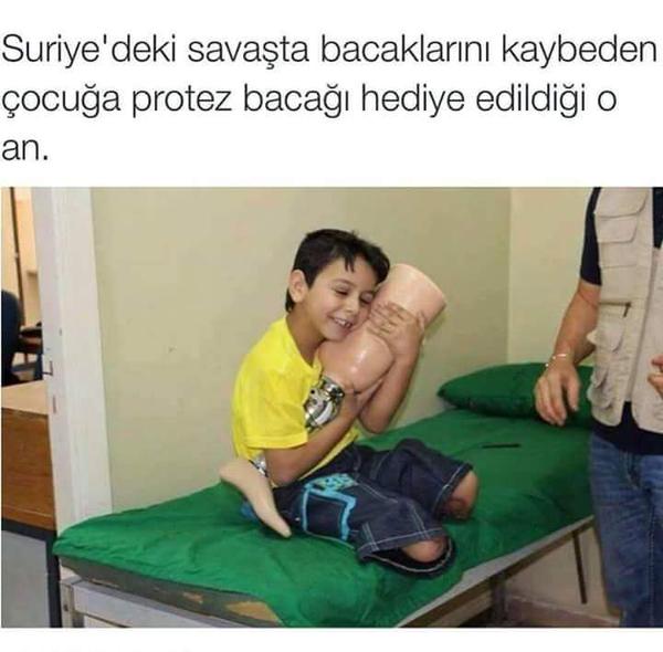mutluluk-protez