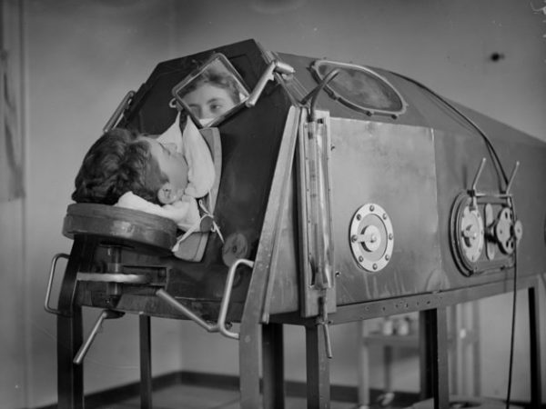 1938:  A patient lying in an artificicial respiration machine called an iron lung.  (Photo by London Express/Getty Images)