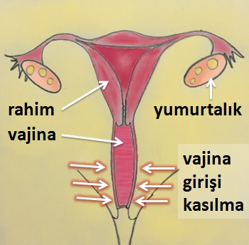 vajinismus-vajina