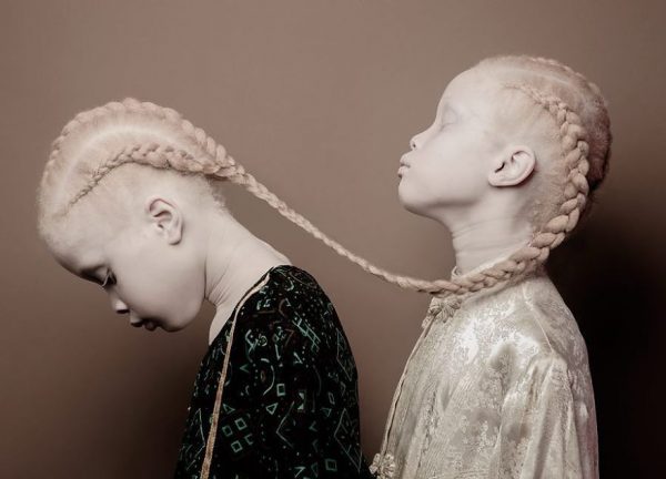 albino-twins-models-10-58e74b0f6915c__880