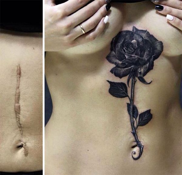 scars-tattoo-cover-up-49-590b2a7232b03__605