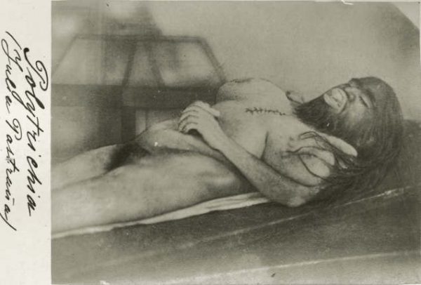 ugliest-people-julia-pastrana-dead