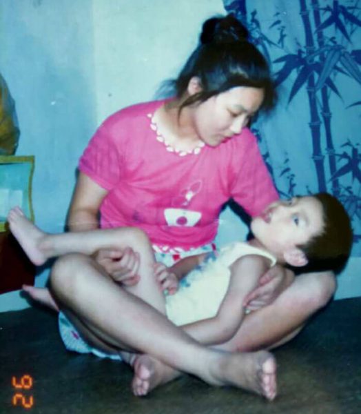 Mother Refused To Give Up Her Disabled Son... 29 Years Later, He's A Harvard Law Student! (1)