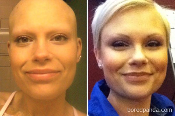 before-after-beating-cancer-1-5992a39e52cdc__700