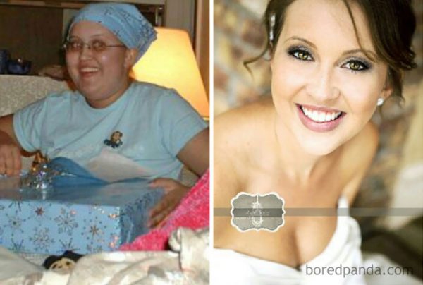 before-after-beating-cancer-103-59940449a6342__700