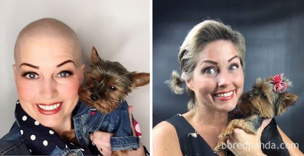 before-after-beating-cancer-19-5992c5ebe2155__700