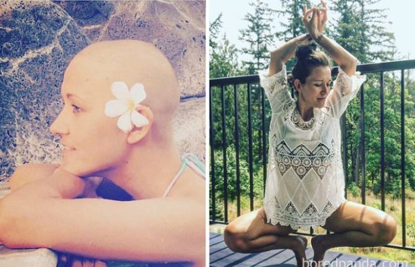 before-after-beating-cancer-36-5996f3c2adbfd__700