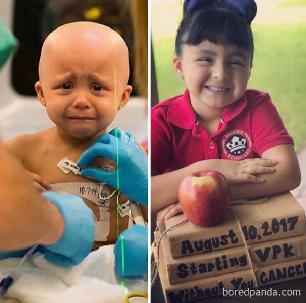 before-after-beating-cancer-38-599a98a411916__700