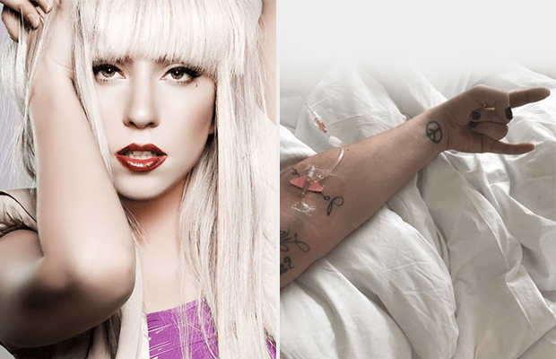 Lady Gaganın gizemli hastalığı: Fibromiyalji 2