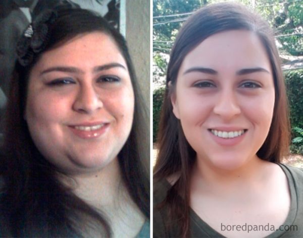 before-after-weight-loss-success-stories-18-59d34f8864564__700