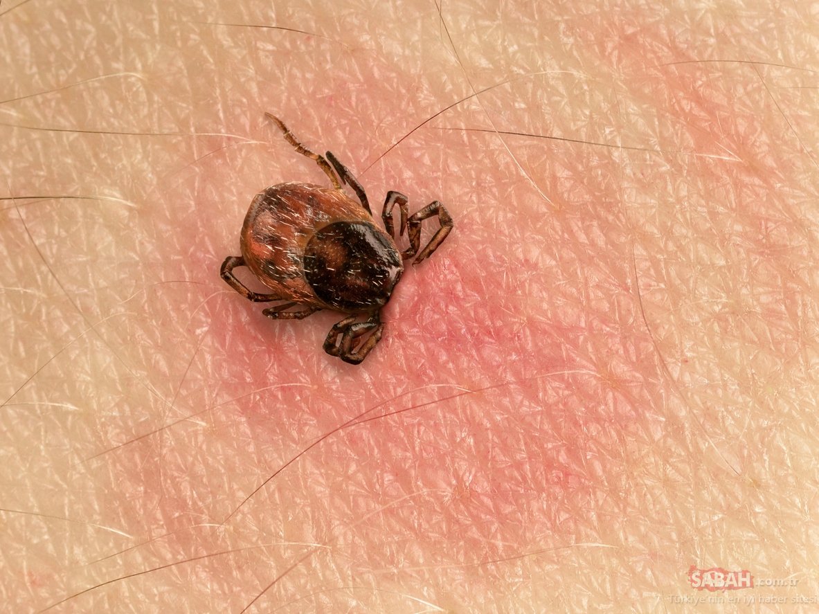 lyme hastalığı justin bieber