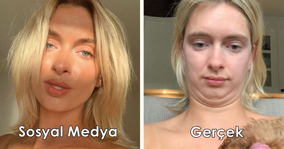 Sosyal medya