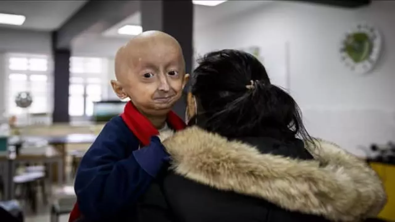 progeria