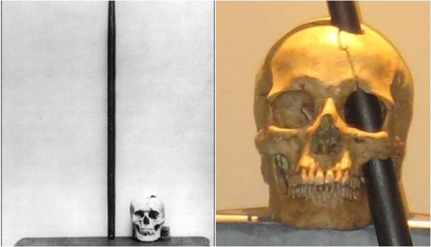 phineas gage